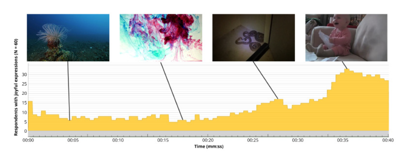 Electroencephalography (EEG) - Data visualization